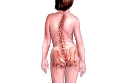 Reasons for the development of cervical osteochondrosis
