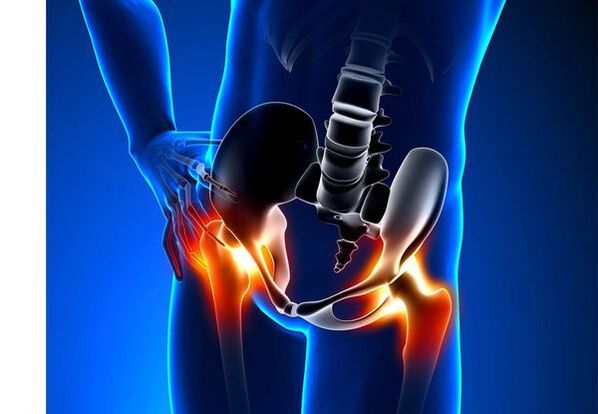 Pain for Coesarthrosis