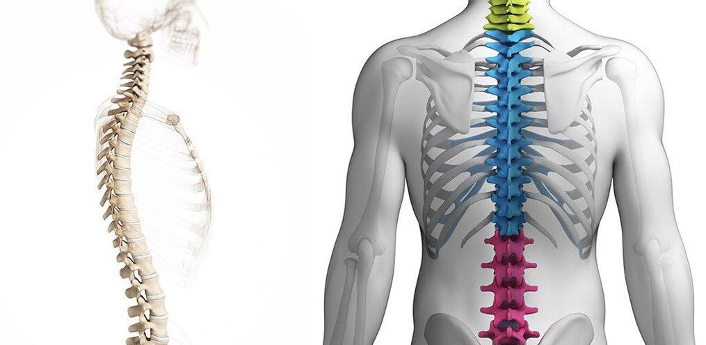 thoracic spine lesion with osteochondrosis