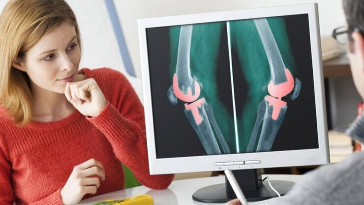 a girl at the doctor's meeting with osteoarthritis